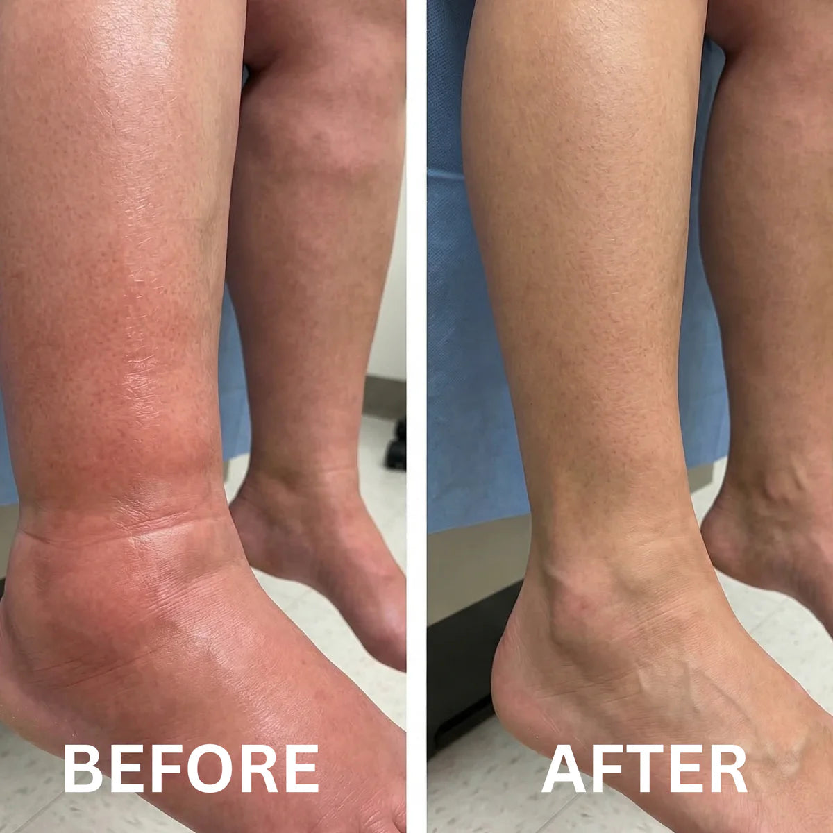 Lymphatic Drainage Drops